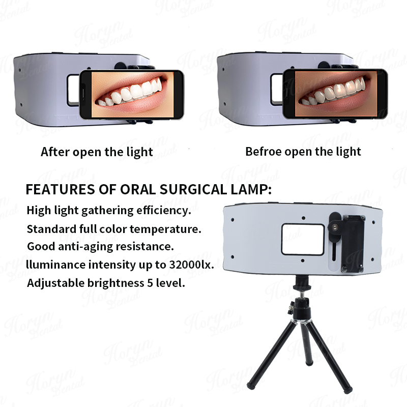 Dental Flash Light Sprzęt foto – Photography Lighting Flash recenzja i cena